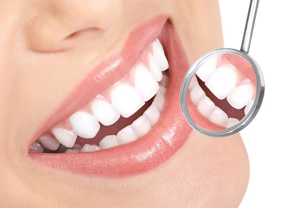 woman-with-white-teeth